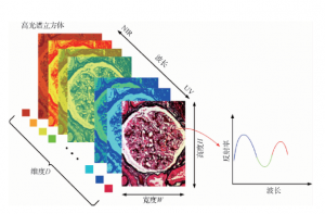 高光譜圖像技術(shù)在醫(yī)學診斷中的重要性
